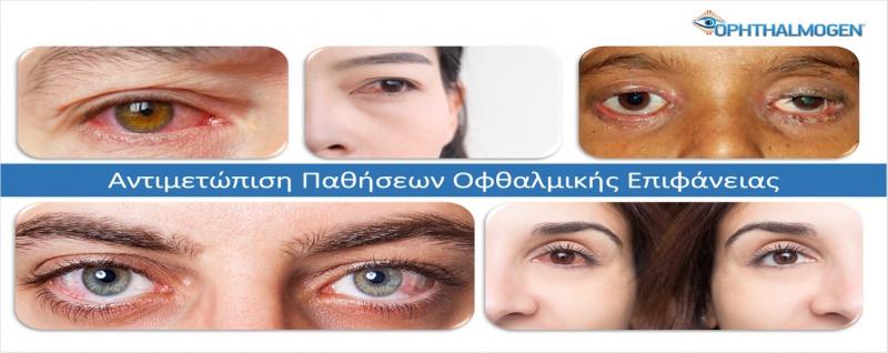 ophthalmogen