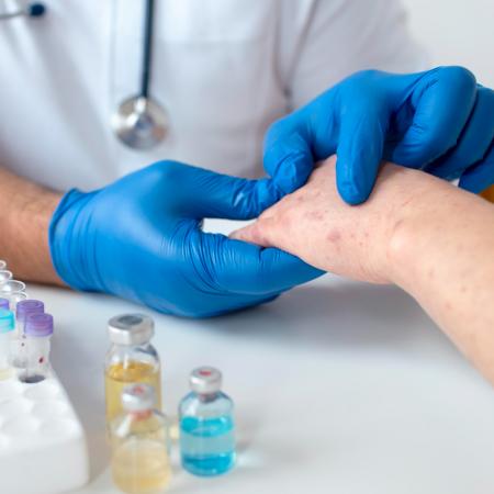 ευλογιά των πιθήκων